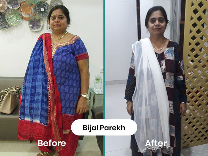Bijal Parekh